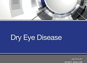 free-pdf-download-Dry Eye Disease – E-Book