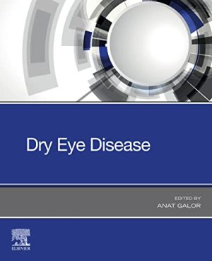 free-pdf-download-Dry Eye Disease – E-Book