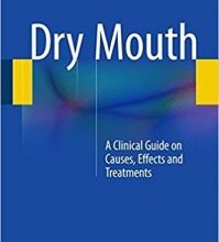 free-pdf-download-Dry Mouth: A Clinical Guide on Causes