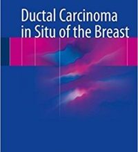 free-pdf-download-Ductal Carcinoma in Situ of the Breast 1st ed. 2018 Edition