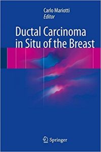 free-pdf-download-Ductal Carcinoma in Situ of the Breast 1st ed. 2018 Edition