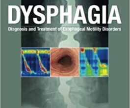 free-pdf-download-Dysphagia: Diagnosis and Treatment of Esophageal Motility Disorders 1st Edition