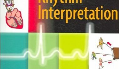 free-pdf-download-E-Z ECG Rhythm Interpretation