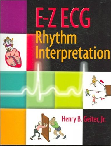 free-pdf-download-E-Z ECG Rhythm Interpretation