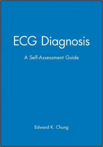 free-pdf-download-ECG Diagnosis: A Self-Assessment Workbook 1st Edition