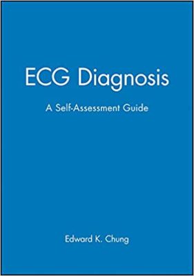 free-pdf-download-ECG Diagnosis: A Self-Assessment Workbook First Edition