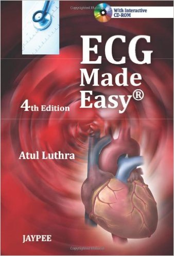 free-pdf-download-ECG Made Easy 4 Pap/Cdr Edition