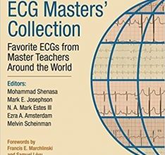 free-pdf-download-ECG Masters Collection: Favorite ECGs from Master Teachers Around the World 1st Edition