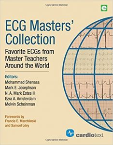 free-pdf-download-ECG Masters Collection: Favorite ECGs from Master Teachers Around the World 1st Edition