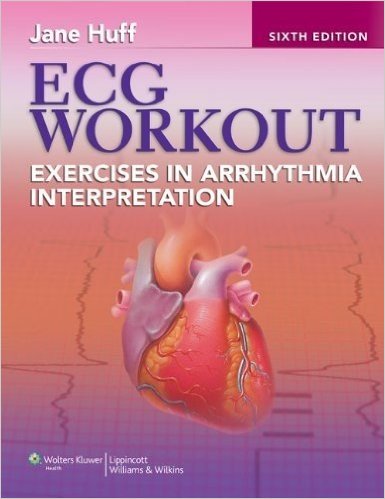 free-pdf-download-ECG Workout: Exercises in Arrhythmia Interpretation (Huff