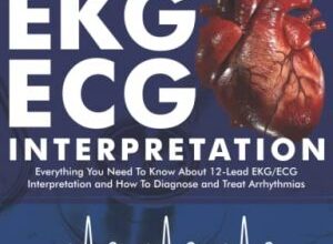 free-pdf-download-EKG/ECG Interpretation second edition