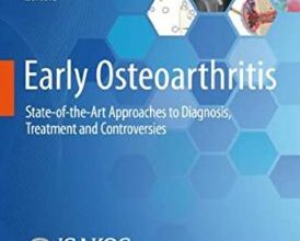 free-pdf-download-Early Osteoarthritis: State of the Art Approaches to Diagnosis