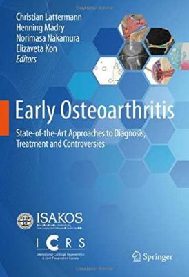 free-pdf-download-Early Osteoarthritis: State of the Art Approaches to Diagnosis