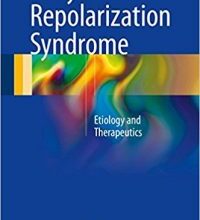 free-pdf-download-Early Repolarization Syndrome: Etiology and Therapeutics 1st ed. 2018 Edition