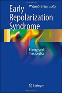 free-pdf-download-Early Repolarization Syndrome: Etiology and Therapeutics 1st ed. 2018 Edition