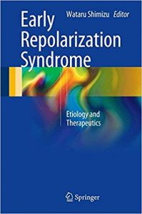 free-pdf-download-Early Repolarization Syndrome: Etiology and Therapeutics 1st ed. 2018 Edition