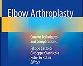 free-pdf-download-Elbow Arthroplasty: Current Techniques and Complications