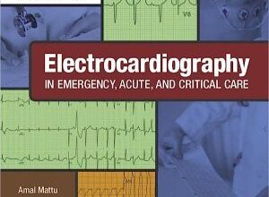 free-pdf-download-Electrocardiography in Emergency