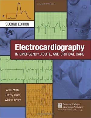 free-pdf-download-Electrocardiography in Emergency