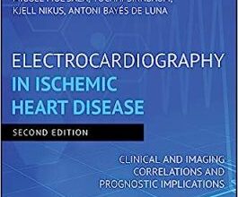 free-pdf-download-Electrocardiography in Ischemic Heart Disease: Clinical and Imaging Correlations and Prognostic Implications 2nd Edition