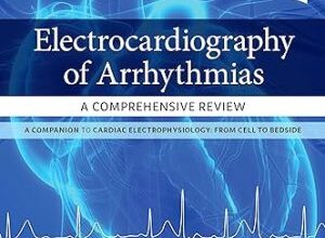 free-pdf-download-Electrocardiography of Arrhythmias: A Comprehensive Review: A Companion to Cardiac Electrophysiology 2nd Edition