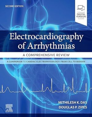 free-pdf-download-Electrocardiography of Arrhythmias: A Comprehensive Review: A Companion to Cardiac Electrophysiology 2nd Edition