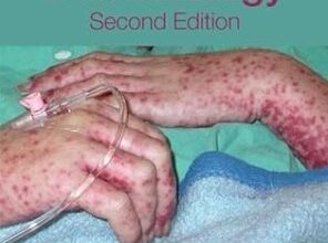 free-pdf-download-Emergency Dermatology 2nd Edition