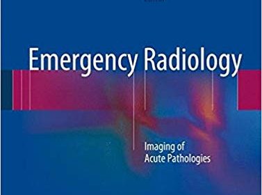 free-pdf-download-Emergency Radiology: Imaging of Acute Pathologies