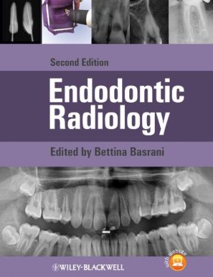 free-pdf-download-Endodontic Radiology 2nd Edition