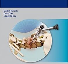 free-pdf-download-Endoscopic Spine Procedures 1 Har/DVD Edition