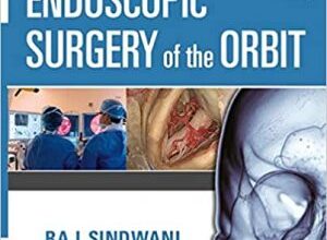 free-pdf-download-Endoscopic Surgery of the Orbit