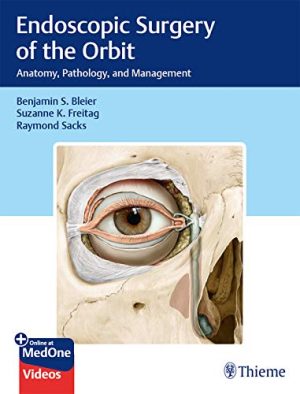 free-pdf-download-Endoscopic Surgery of the Orbit: Anatomy