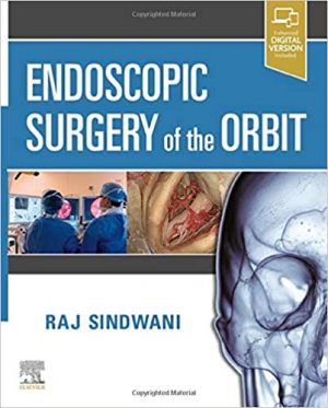 free-pdf-download-Endoscopic Surgery of the Orbit