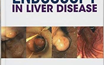 free-pdf-download-Endoscopy in Liver Disease 1st Edition