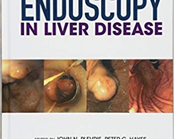 free-pdf-download-Endoscopy in Liver Disease 1st Edition