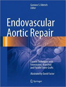 free-pdf-download-Endovascular Aortic Repair: Current Techniques with Fenestrated