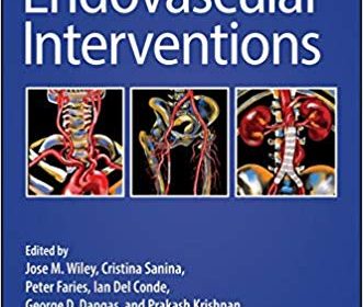 free-pdf-download-Endovascular Interventions 1st Edition