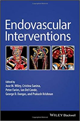 free-pdf-download-Endovascular Interventions 1st Edition