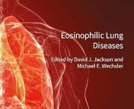 free-pdf-download-Eosinophilic Lung Diseases: 94 (ERS Monograph)