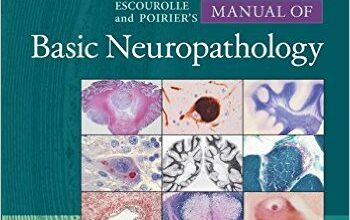 free-pdf-download-Escourolle & Poirier’s Manual of Basic Neuropathology 5th Edition