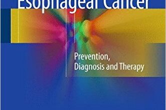 free-pdf-download-Esophageal Cancer: Prevention