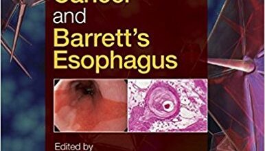 free-pdf-download-Esophageal Cancer and Barrett’s Esophagus 3rd Edition