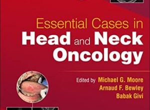 free-pdf-download-Essential Cases in Head and Neck Oncology