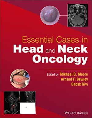 free-pdf-download-Essential Cases in Head and Neck Oncology