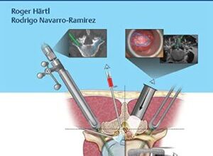 free-pdf-download-Essential Step-by-Step Techniques for Minimally Invasive Spinal Surgery