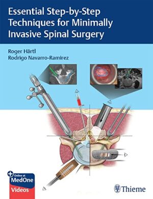 free-pdf-download-Essential Step-by-Step Techniques for Minimally Invasive Spinal Surgery