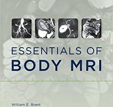 free-pdf-download-Essentials of Body MRI 1st Edition