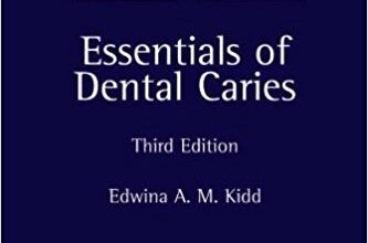 free-pdf-download-Essentials of Dental Caries: The Disease and Its Management 3rd Edition