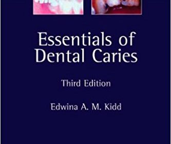 free-pdf-download-Essentials of Dental Caries: The Disease and Its Management 3rd Edition