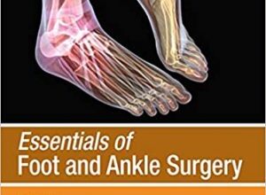 free-pdf-download-Essentials of Foot and Ankle Surgery